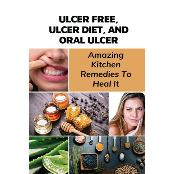 Ulcer Free, Ulcer Diet, And Oral Ulcer: Amazing Kitchen Remedies To Heal It: How Do You Get Rid Of Mouth Ulcers Overnight? (Paperback)