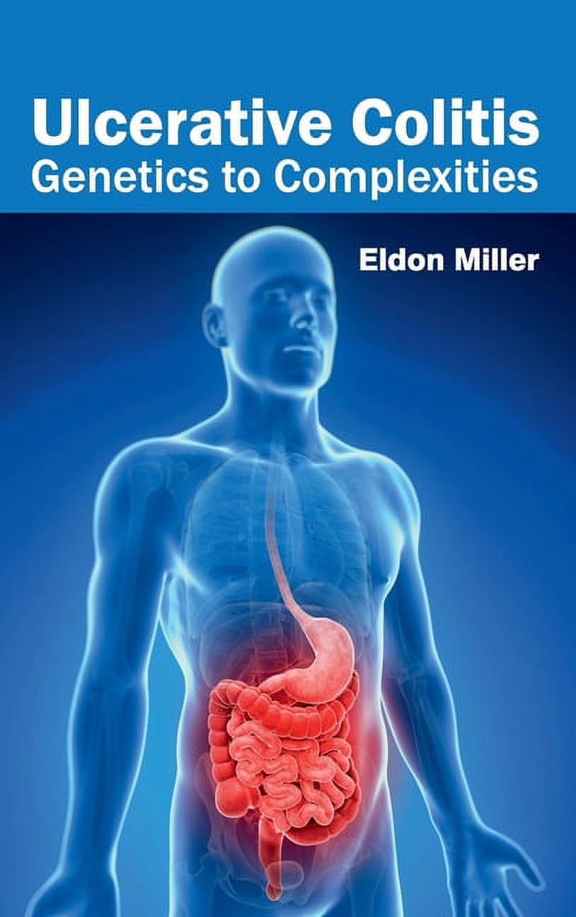 Ulcerative Colitis to Complexities (Hardcover)