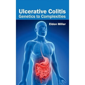 Ulcerative Colitis: Genetics to Complexities, (Hardcover)
