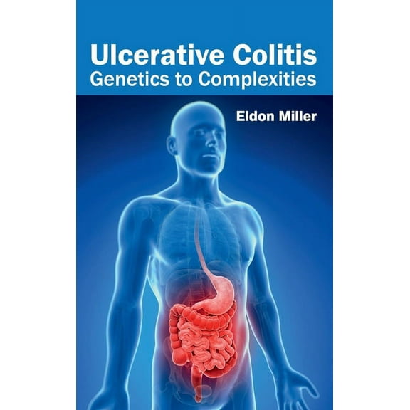 Ulcerative Colitis: Genetics to Complexities, (Hardcover)