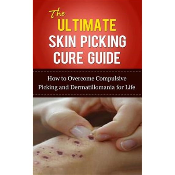 Ultimate Skin Picking Cure Guide : How to Overcome Compulsive Picking and Dermatillomania for Life