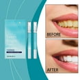 UltraBright Teeth Whitening Pen 2Pack Stain Whitener Dentist