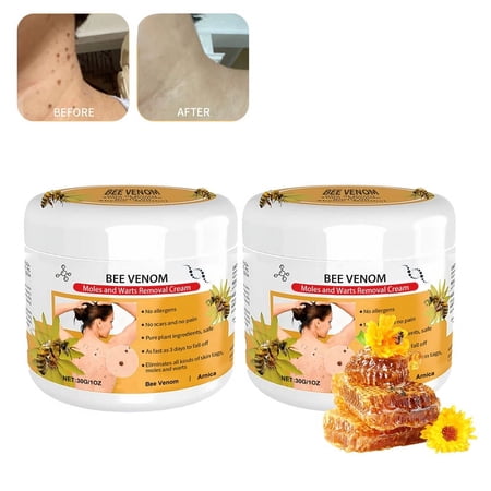 Ultra-strong Bee peptideTag Skin Removal Cream Skin Care Cream,Body Wart Removal Cream,Rapid Acting-2PCS