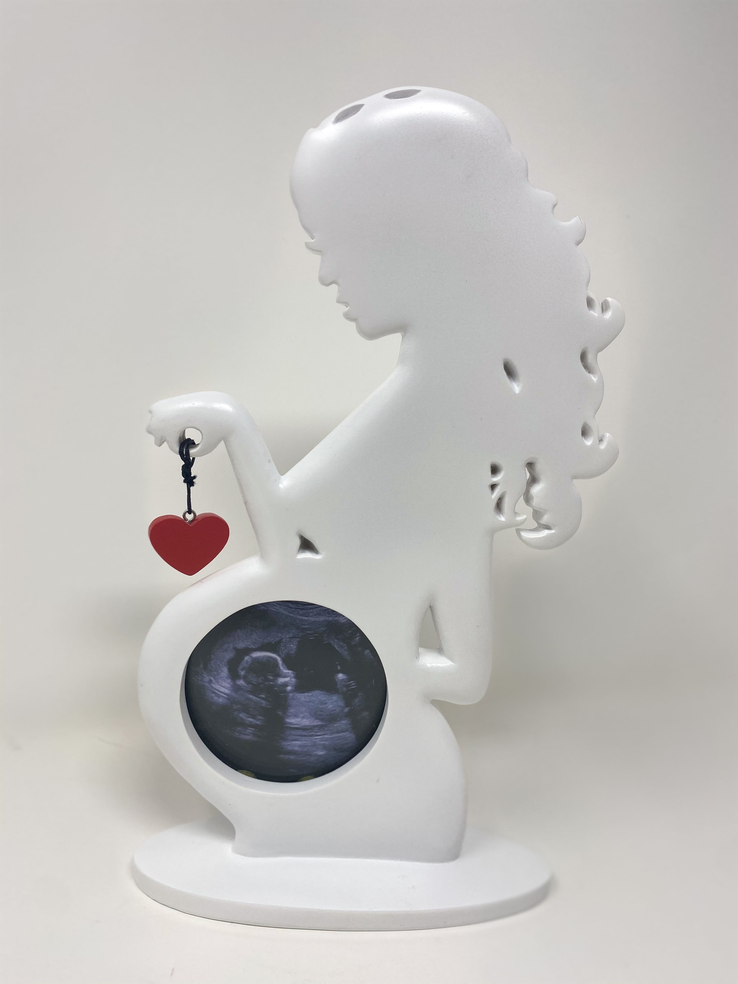 Ultrasound Picture Frame