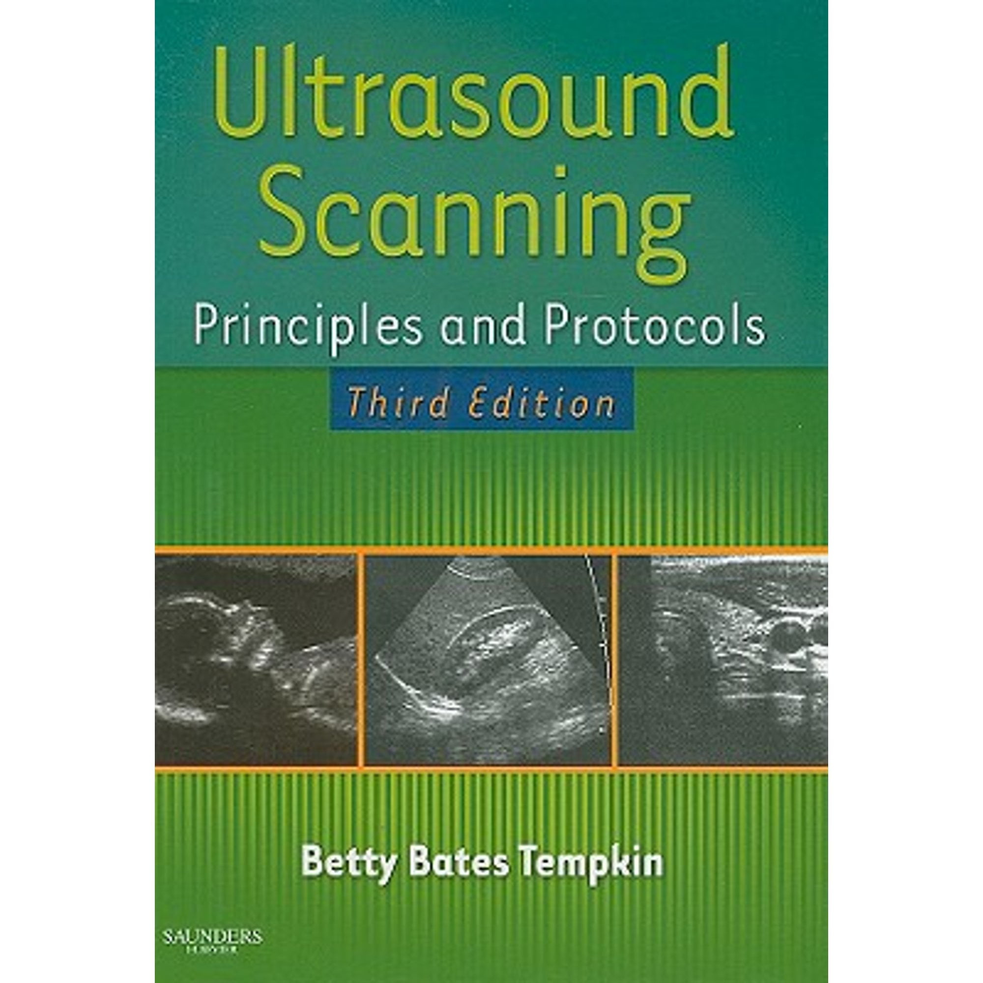 Pre-Owned Ultrasound Scanning: Principles and Protocols (Hardcover 9780721606361) by Betty Bates Tempkin