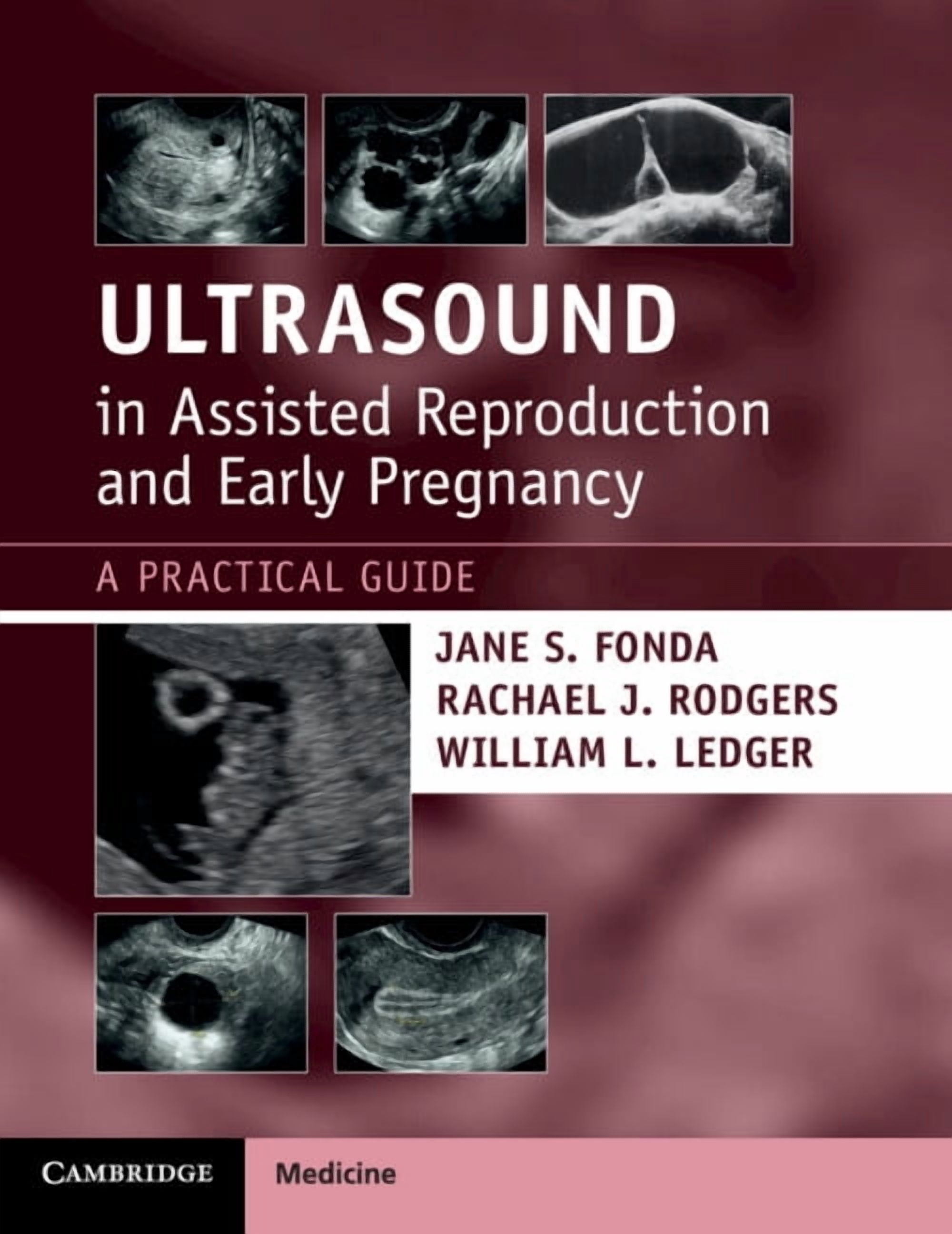 Ultrasound in Assisted Reproduction and Early Pregnancy: A Practical Guide, (Paperback)