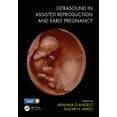 thumbnail image 1 of Ultrasound in Assisted Reproduction and Early Pregnancy (Paperback), 1 of 1
