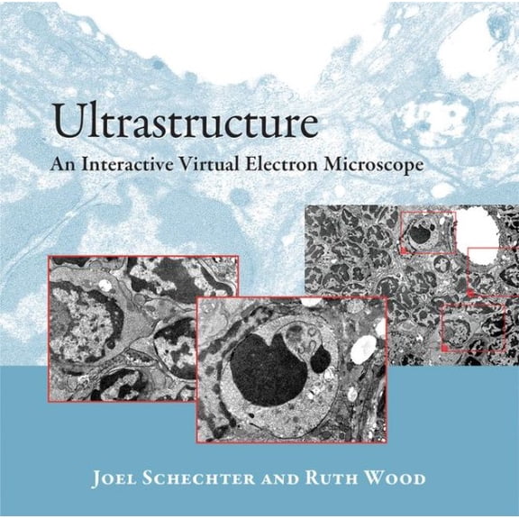 Ultrastructure : An Interactive Virtual Electron Microscope