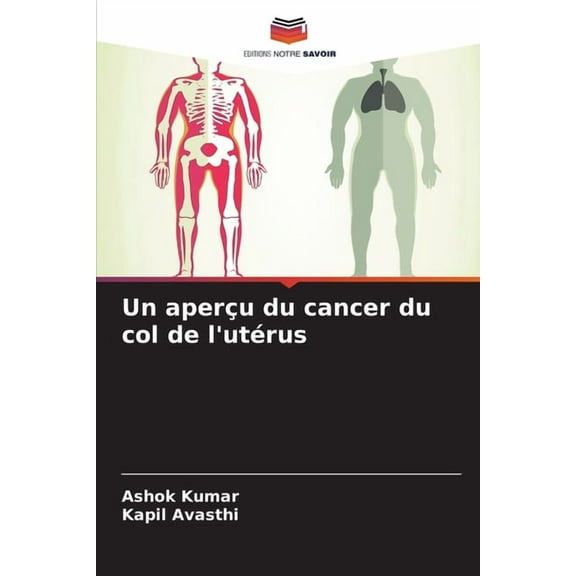 Un aperu du cancer du col de l'utrus, (Paperback)