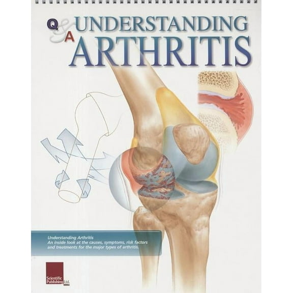Understanding Arthritis Flip Chart (Other)