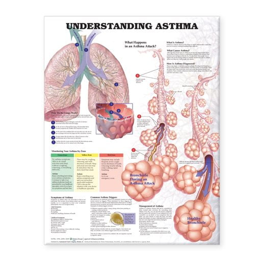 Understanding Asthma Anatomical Chart (Other)