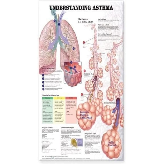 Understanding Asthma