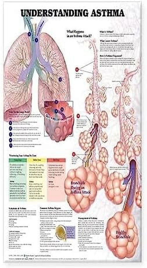 Understanding Asthma