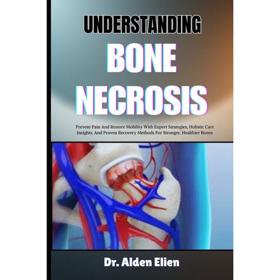 Understanding Bone Necrosis: Prevent Pain And Restore Mobility With Expert Strategies, Holistic Care Insights, And Prove, (Paperback)