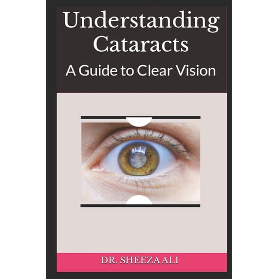 Understanding Cataracts: A Guide to Clear Vision, (Paperback)