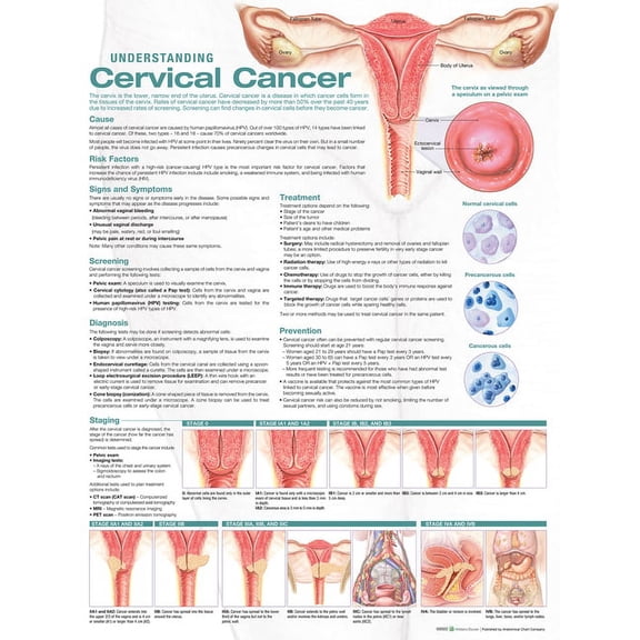 Understanding Cervical Cancer Anatomical Chart (Other)