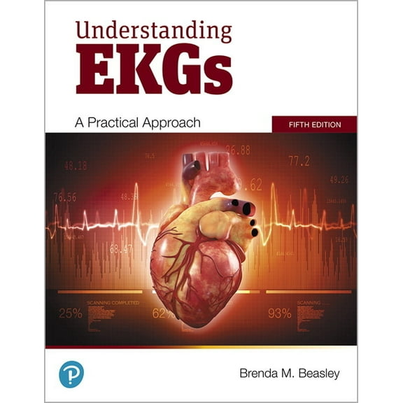 Understanding EKGs: A Practical Approach, (Paperback)