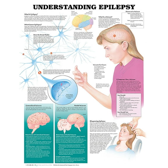 Understanding Epilepsy Anatomical Chart