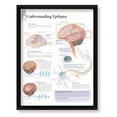 thumbnail image 1 of Understanding Epilepsy Framed Medical Educational Informational Poster Diagram Doctors Office School Classroom 22x28 Inches, 1 of 2
