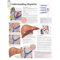 thumbnail image 1 of Understanding Hepatitis chart : Wall Chart (Wallchart), 1 of 1