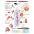 thumbnail image 1 of Understanding Hypertension, 1 of 1
