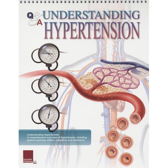 Understanding Hypertension Flip Chart (Other)