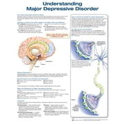 Understanding Major Depressive Disorder Other