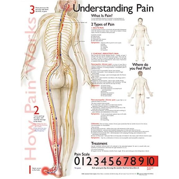 Understanding Pain Anatomical Chart (Other)