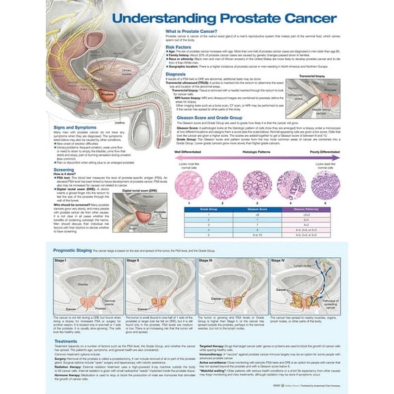 Understanding Prostate Cancer Anatomical Chart (Other)