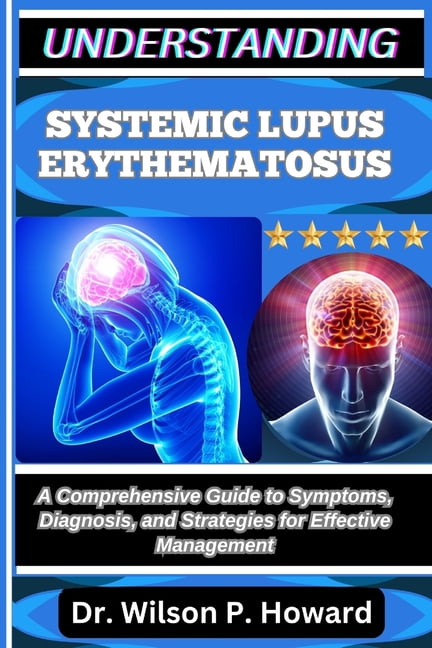 Understanding Systemic Lupus Erythematosus: A Comprehensive Guide to ...