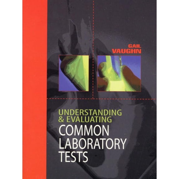 Pre-Owned Understanding and Evaluating Common Laboratory Tests (Paperback) 0838592732 9780838592731