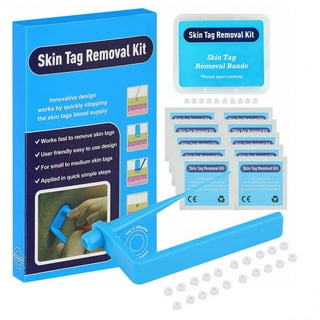 Freeze Away Skin Tag Remover - Skin Tag