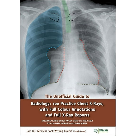 The Unofficial Guide to Radiology: 100 Practice Chest X Rays with Full Colour Annotations and Full X (Paperback) by Mohammed Rashid Akhtar, Rebecca Best, Lydia Shackshaft