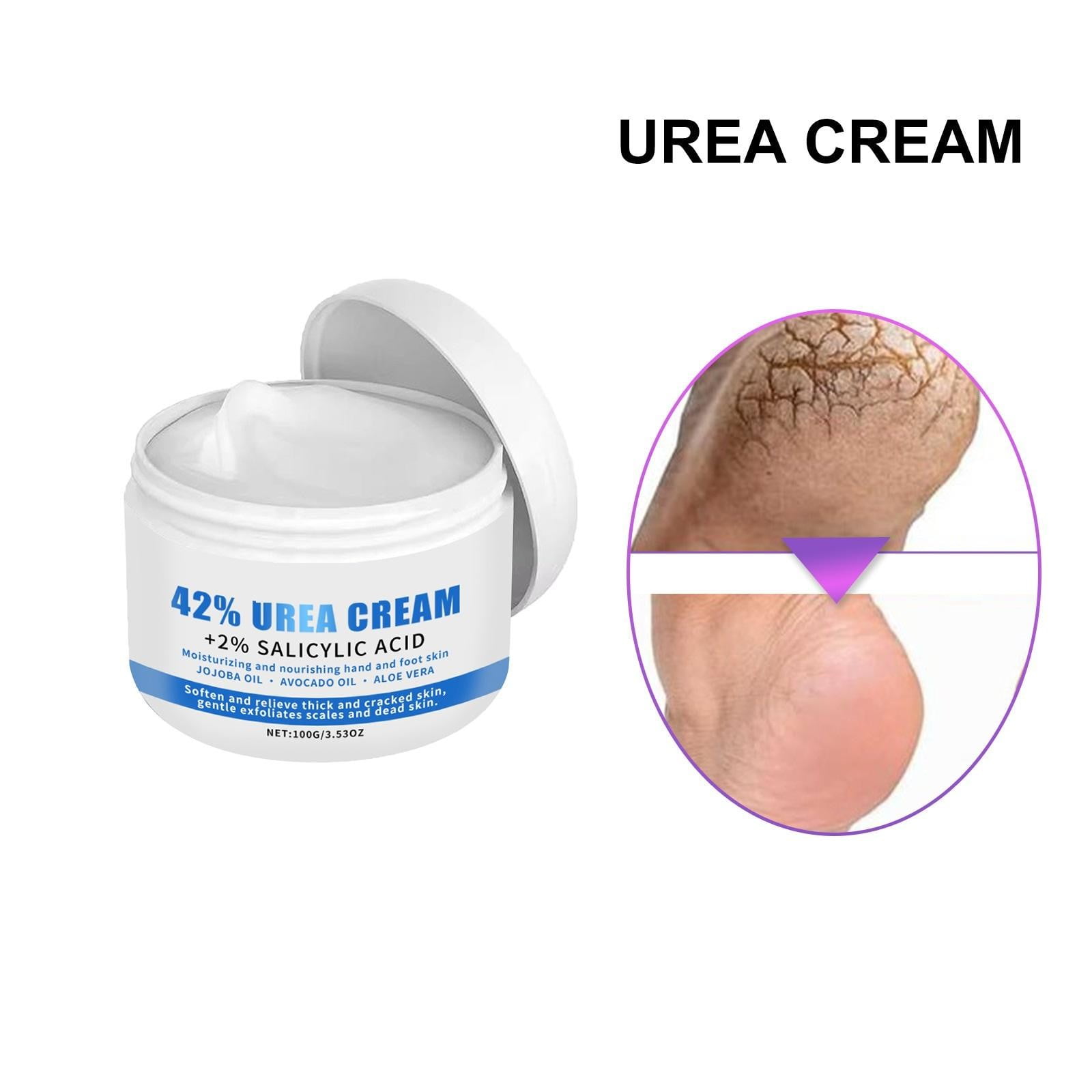 Urea Cream 42, Foot Cream For Dry Cracked Heels, Urea Cream 42 Percent