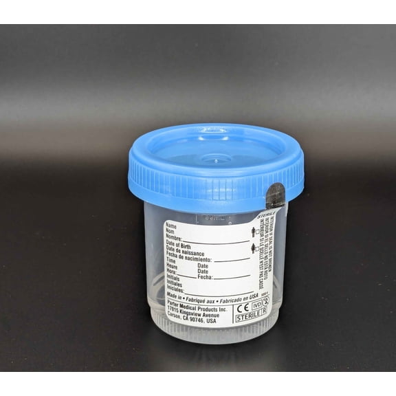 Urine Analysis (CPT 87086)