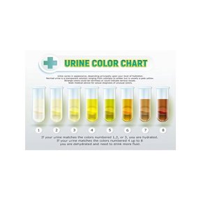 Urine Color Guide Poster Hydration Reference Chart Wall Art For Bathroom Clinic Health Center Office Decor