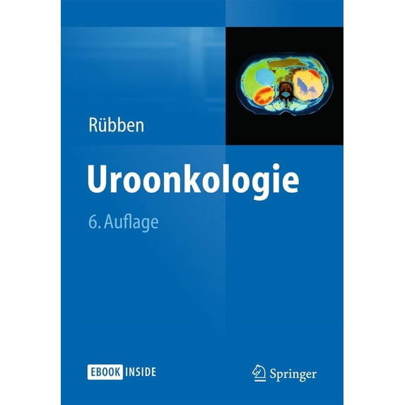 Uroonkologie, (Paperback)