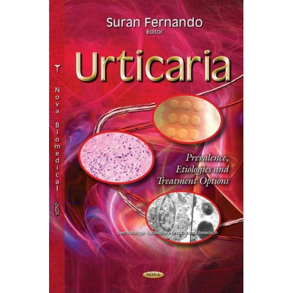 Urticaria : Prevalence, Etiologies and Treatment Options