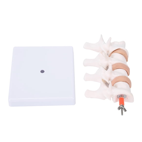 UsilkU Professional Osteoporosis Human Anatomical Spine Model for Medical Teaching Demonstration, Orthopedic Study and Classroom Education, Premium PVC Anatomy Tool, 5.91 Inches / 15 cm