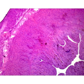 Uterus, Human; Showing General Structure; Section by Go Science Crazy