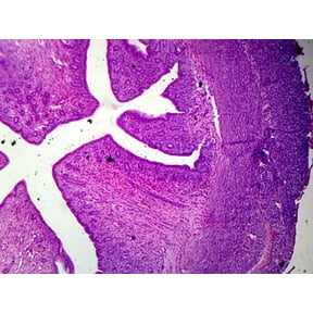Uterus, Mammalian; Showing General Structures; Section