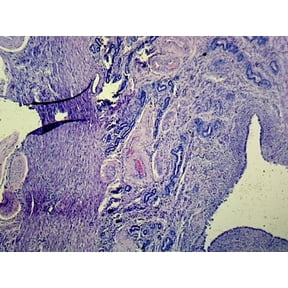 Uterus in Secretory Phase, Human; Section