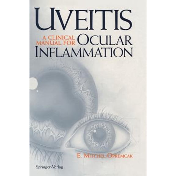 Pre-Owned Uveitis: A Clinical Manual for Ocular Inflammation (Hardcover) 0387942475 9780387942476