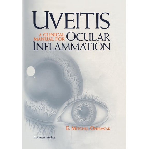 Uveitis: A Clinical Manual for Ocular Inflammation, (Paperback)