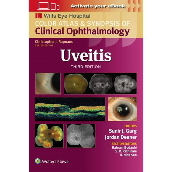 Wills Eye Institute Atlas Uveitis, (Paperback)