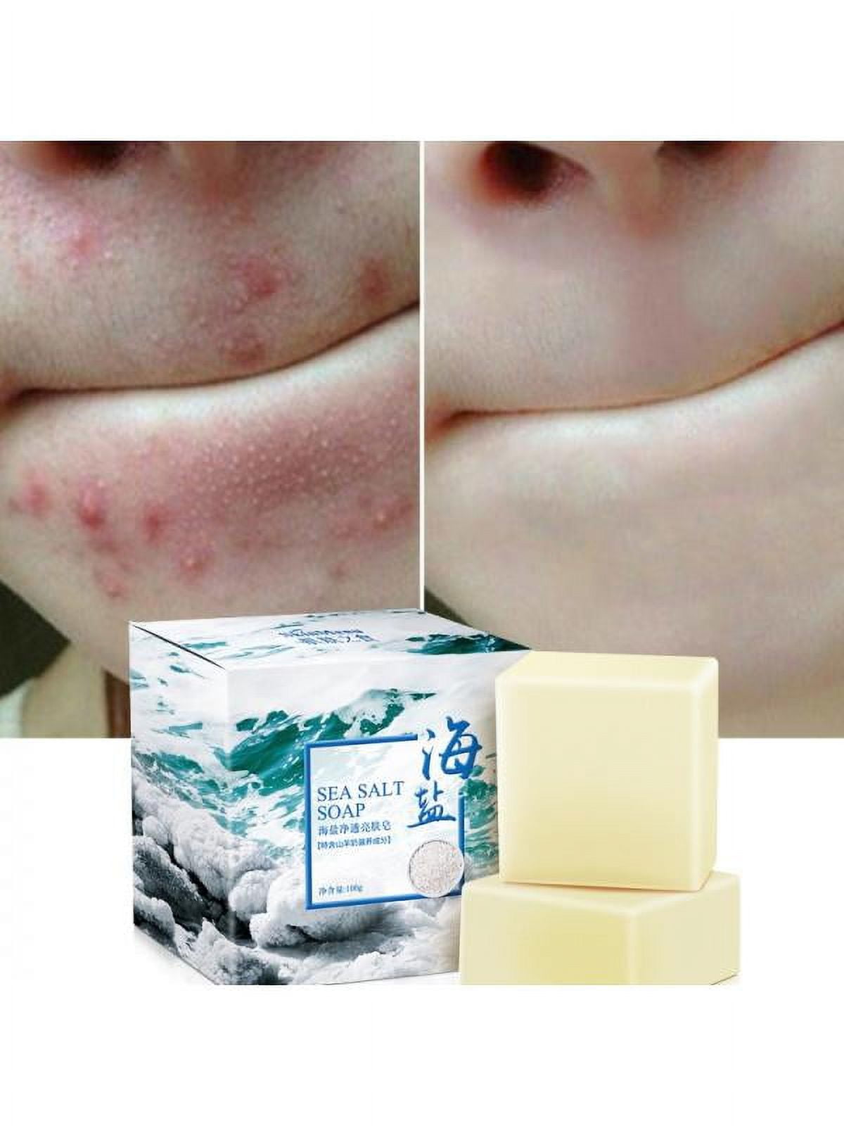 VICOODA Sea Salt Soap Bar Natural with Goat s Milk Blackhead Acne Scars Anti Cellulite Remover Soap Deep Facial Cleaning for Natural Dry And Oily
