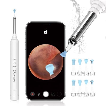 VITCOCO, Ear Wax Removal Kit, Ear Cleaner tool, 1920P HD Ear Camera,3.0 mm Ear Wax Removal Otoscope with 6 LED Powerful Lights for iPhone, Android & iPad