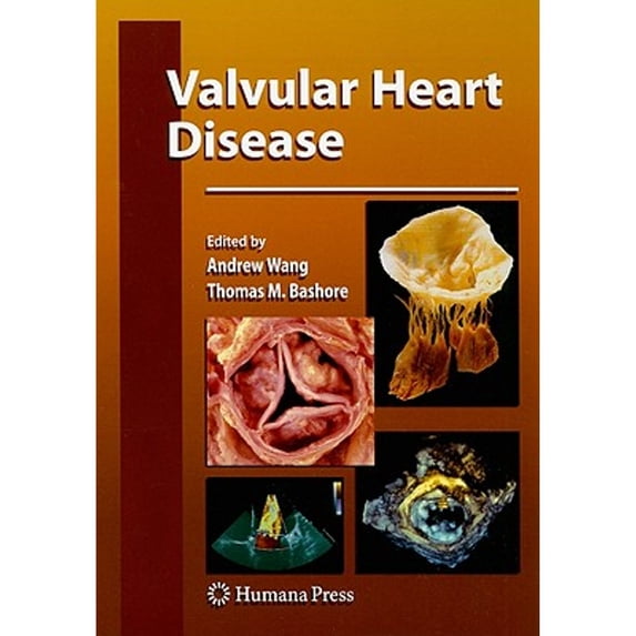 Pre-Owned Valvular Heart Disease (Contemporary Cardiology), 9781588299826, 1588299821, Hardcover, 2009 edition