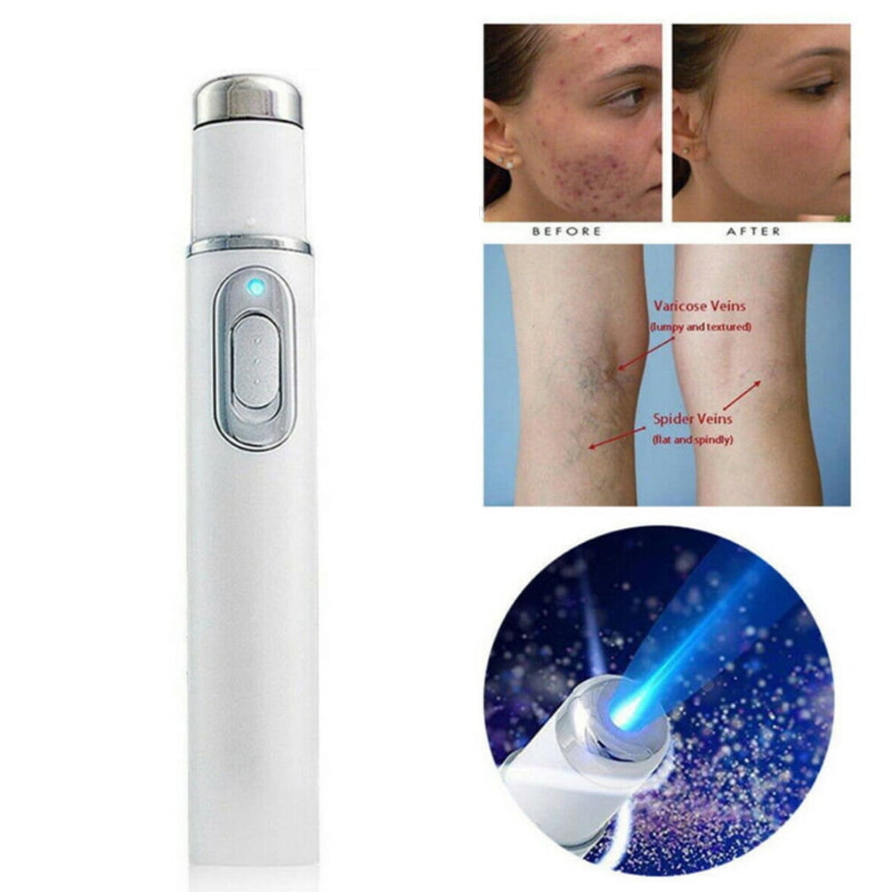 Varicose Veins Blue Light Therapy Set Varicose Vein Cream and Blue