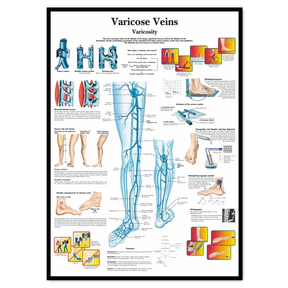Medical Human Chart Shoulder and Elbow Medical Poster Wall Art - Human Anatomy Picture ...